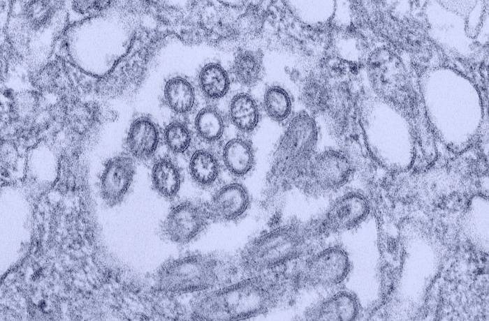 Microscope view of influenza
